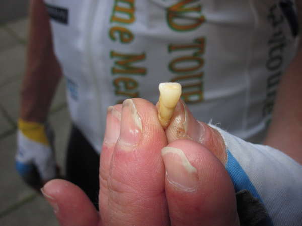 fichier 20150531_0546_015brm_600k_arrivee_grenoble_maurice_rouchon_dent_cassee-0.jpg